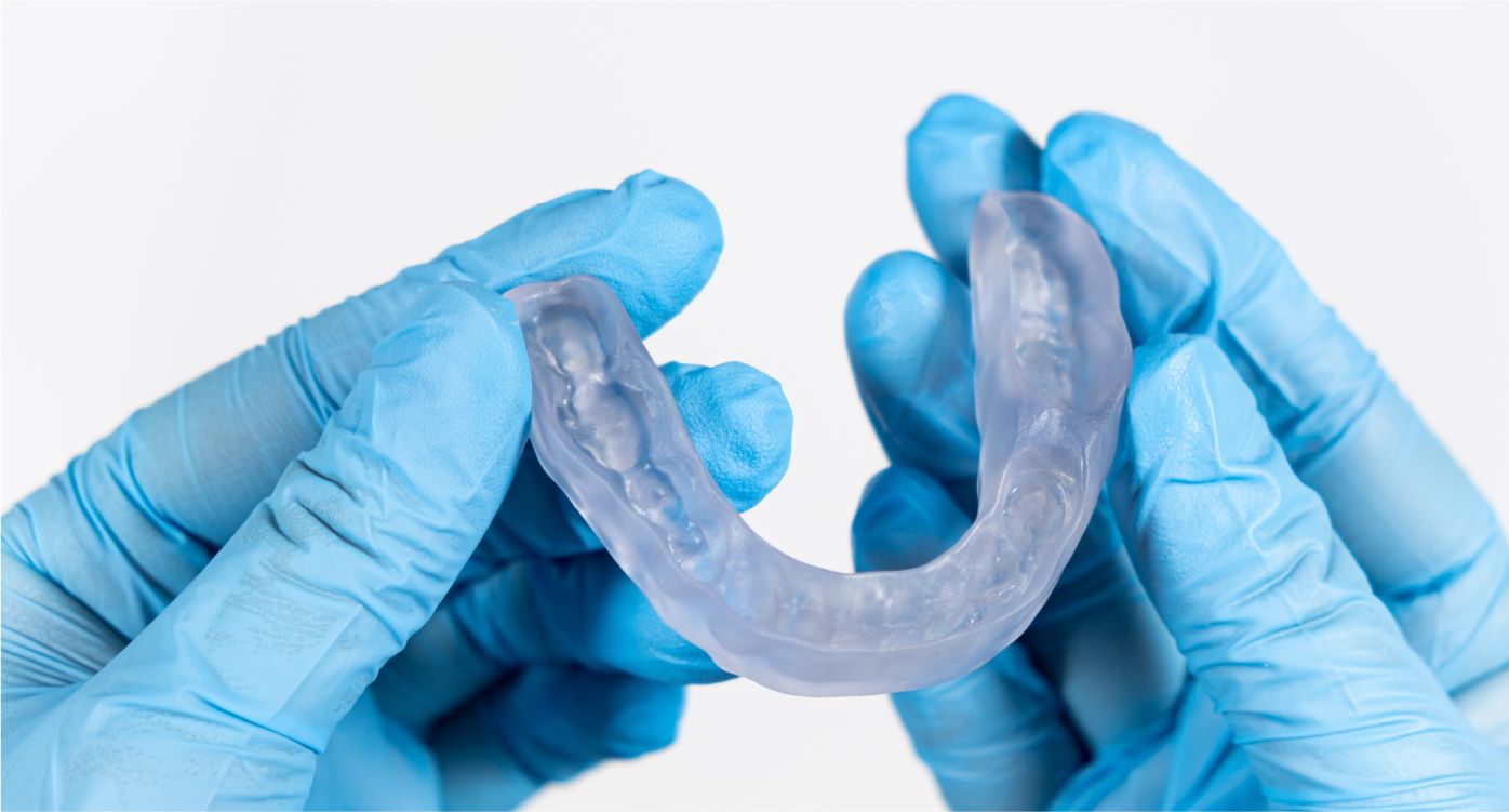 A high-quality, custom-fit oral appliance showing the precision engineering and custom design.